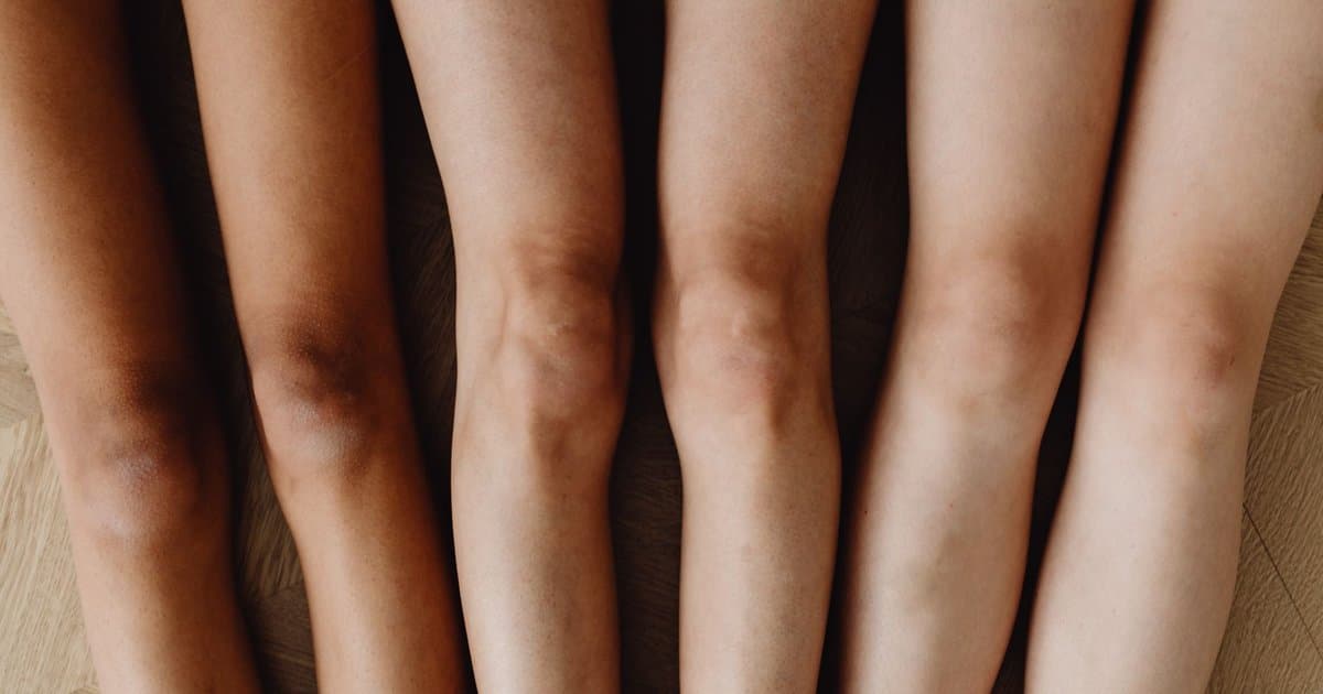 Four Reasons Your Knees Hurt When You Squat