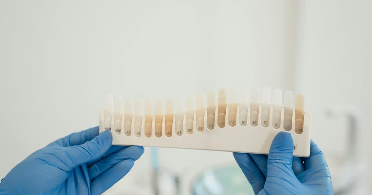 What Dentists Don't Want You to Know About Whitening